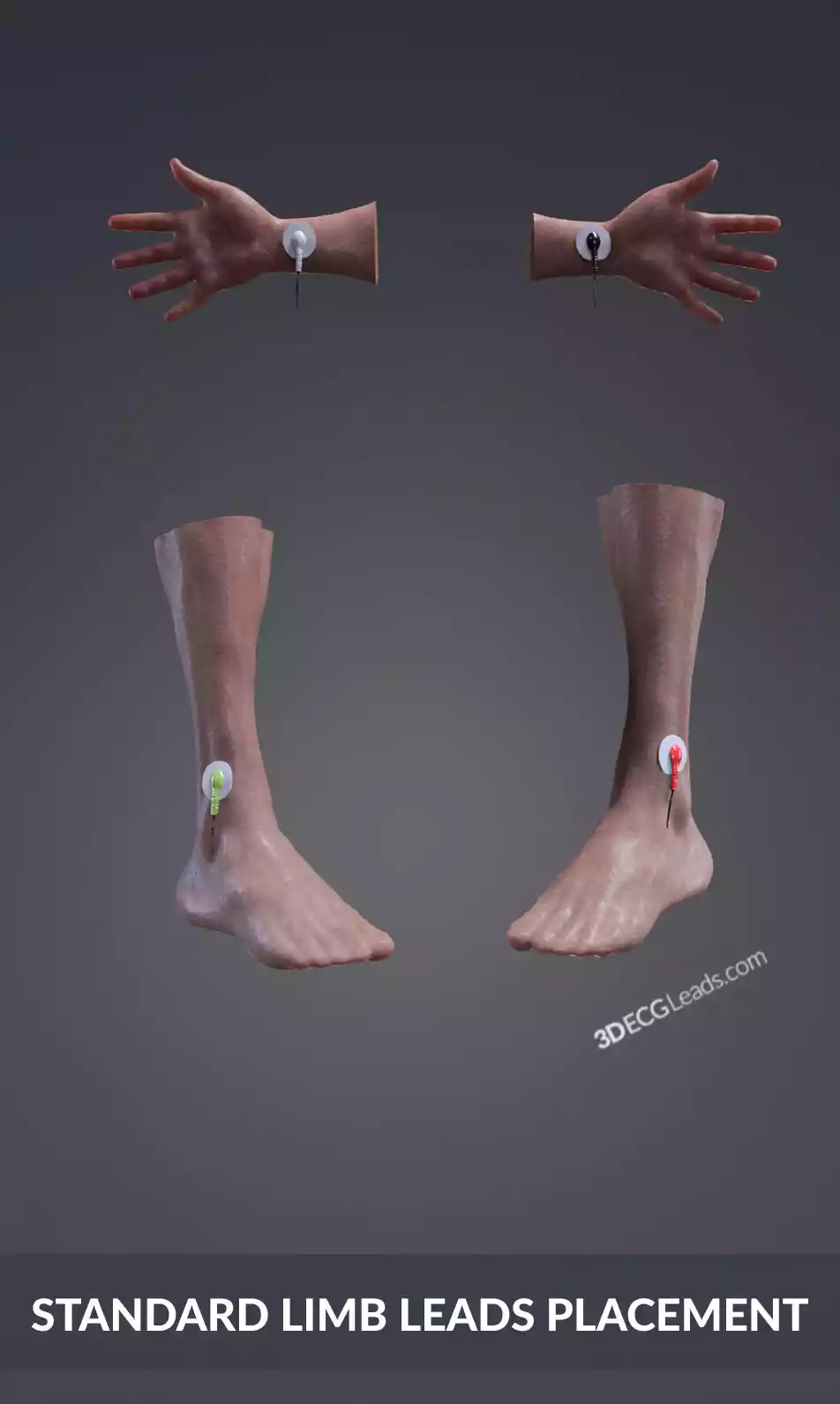 how to place ecg limb leads